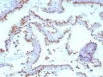 Prostein (p501S)/Solute Carrier Family 45 Member 3 (SLC45A3) Antibody in Immunohistochemistry (Paraffin) (IHC (P))