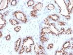 Prostein (p501S)/Solute Carrier Family 45 Member 3 (SLC45A3) Antibody in Immunohistochemistry (Paraffin) (IHC (P))