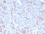 MRP3 (Multidrug Resistance-Associated Protein 3) Antibody in Immunohistochemistry (Paraffin) (IHC (P))