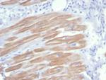 Sarcomeric Actinin Alpha 2/ACTN2 Antibody in Immunohistochemistry (Paraffin) (IHC (P))