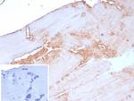 Sarcomeric Actinin Alpha 2/ACTN2 Antibody in Immunohistochemistry (Paraffin) (IHC (P))