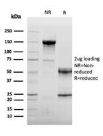 Sarcomeric Actinin Alpha 2/ACTN2 Antibody in SDS-PAGE (SDS-PAGE)