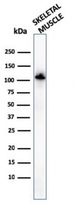 Sarcomeric Actinin Alpha 2/ACTN2 Antibody in Western Blot (WB)