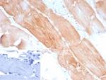 Sarcomeric Actinin Alpha 2/ACTN2 Antibody in Immunohistochemistry (Paraffin) (IHC (P))