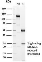 Sarcomeric Actinin Alpha 2/ACTN2 Antibody in SDS-PAGE (SDS-PAGE)