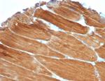 Sarcomeric Actinin Alpha 2/ACTN2 Antibody in Immunohistochemistry (Paraffin) (IHC (P))