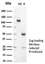 Sarcomeric Actinin Alpha 2/ACTN2 Antibody in SDS-PAGE (SDS-PAGE)