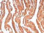 Sarcomeric Actinin Alpha 2/ACTN2 Antibody in Immunohistochemistry (Paraffin) (IHC (P))