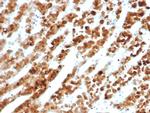 IL18RAP/CD218b Antibody in Immunohistochemistry (Paraffin) (IHC (P))