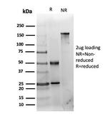 Histone Deacetylase 1 (HDAC3) Antibody in SDS-PAGE (SDS-PAGE)