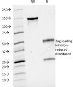 Cyclin A2 (S- and G2-phase Cyclin) Antibody in SDS-PAGE (SDS-PAGE)