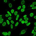 Cyclin B1 (G2- and M-phase Cyclin) Antibody in Immunocytochemistry (ICC/IF)