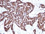 Cyclin B1 (G2- and M-phase Cyclin) Antibody in Immunohistochemistry (Paraffin) (IHC (P))