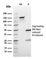 BCL10 Antibody in SDS-PAGE (SDS-PAGE)