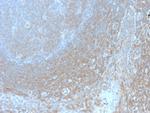 BCL10 Antibody in Immunohistochemistry (Paraffin) (IHC (P))