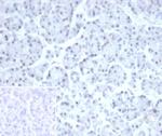 PHOX2B Antibody in Immunohistochemistry (Paraffin) (IHC (P))