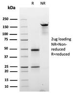 Cyclin E (G1/S-Phase Cyclin) Antibody in SDS-PAGE (SDS-PAGE)