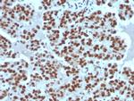 Cyclin E (G1/S-Phase Cyclin) Antibody in Immunohistochemistry (Paraffin) (IHC (P))