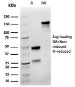 Cyclin E (G1/S-Phase Cyclin) Antibody in SDS-PAGE (SDS-PAGE)