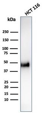 Cyclin E (G1/S-Phase Cyclin) Antibody in Western Blot (WB)