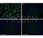 Yersinia enterocolitica O:9 Antibody in Immunocytochemistry (ICC/IF)