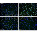 Yersinia enterocolitica O:9 Antibody in Immunocytochemistry (ICC/IF)