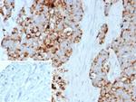 GPRC5A/PEIG-1/RAI3/RAIG1/TIG1 Antibody in Immunohistochemistry (Paraffin) (IHC (P))