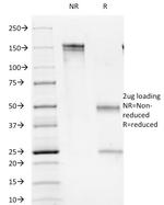 CD1b (T-Cell Surface Glycoprotein) Antibody in SDS-PAGE (SDS-PAGE)