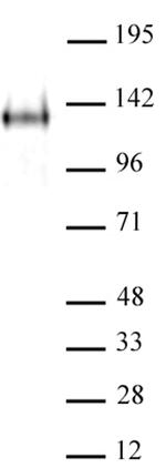 JMJD2A Antibody in Western Blot (WB)