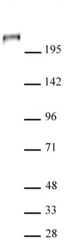 TET1 Antibody in Western Blot (WB)