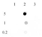 5-methylcytosine Antibody in Dot Blot (DB)