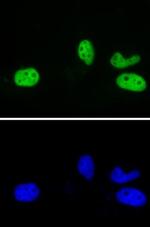 Rad21 Antibody in Immunocytochemistry (ICC/IF)