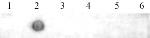 N6-Methyladenosine (m6A) Antibody in Dot Blot (DB)