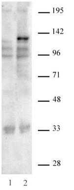 SaCas9 Antibody in Western Blot (WB)