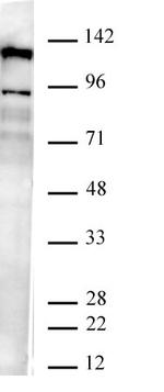 JMJD2B / KDM4B Antibody in Western Blot (WB)