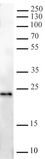 TWIST Antibody in Western Blot (WB)