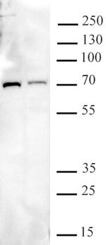 METTL3 Antibody in Western Blot (WB)