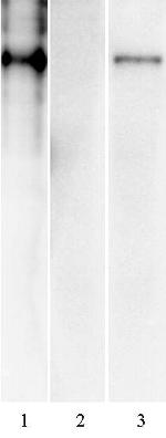 SARS-CoV-2 Spike Antibody in Western Blot (WB)