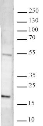 Histone H3K27me3 Antibody in Western Blot (WB)