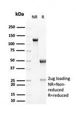 RCAS1/Estrogen Receptor Binding Site Associated Antigen 9 Antibody in Immunoelectrophoresis (IE)