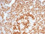 RCAS1/Estrogen Receptor Binding Site Associated Antigen 9 Antibody in Immunohistochemistry (Paraffin) (IHC (P))