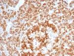 RCAS1/Estrogen Receptor Binding Site Associated, Antigen 9 Antibody in Immunohistochemistry (Paraffin) (IHC (P))