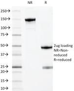 Myeloid-Associated Differentiation Marker (MYADM) Antibody in SDS-PAGE (SDS-PAGE)