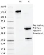 Myeloid-Associated Differentiation Marker (MYADM) Antibody in SDS-PAGE (SDS-PAGE)