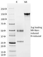 CD4 (T-Helper/Inducer Cell Marker) Antibody in SDS-PAGE (SDS-PAGE)