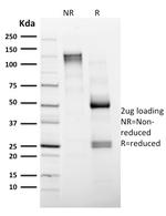 CD4 (T-Helper/Inducer Cell Marker) Antibody in SDS-PAGE (SDS-PAGE)