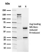 CD4 (T-Helper/Inducer Cell Marker) Antibody in SDS-PAGE (SDS-PAGE)