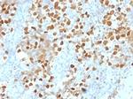 ZMYM3 Antibody in Immunohistochemistry (Paraffin) (IHC (P))