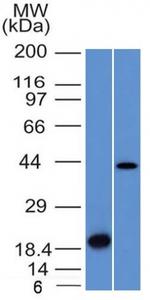 Aurora B Antibody in Western Blot (WB)