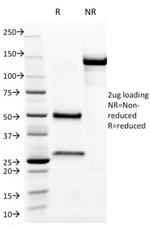 Aurora B Antibody in SDS-PAGE (SDS-PAGE)